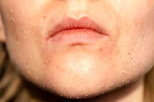 روش‌هایی ساده برای کاهش خشکی پوست در پاییز